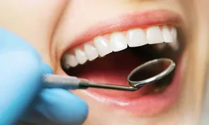 Nuôi cấy thành công răng trong phòng thí nghiệm Nuôi cấy thành công răng trong phòng thí nghiệm